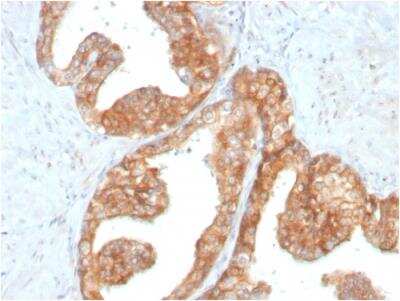 Immunohistochemistry-Paraffin: Ret Antibody (RET/2795) - Azide and BSA Free [NBP2-79897]