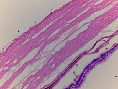 Hematoxylin & Eosin Stain: Retina Tissue Slides (Adult Normal)- Frozen [NBP2-77557]