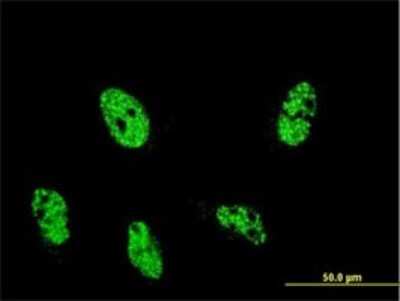 Immunocytochemistry/ Immunofluorescence: Retinoblastoma binding protein 1 Antibody (2G8) [H00005926-M01]
