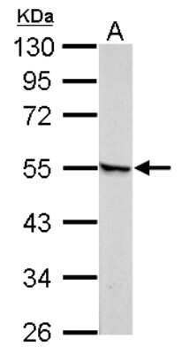 Western Blot: RAR gamma/NR1B3 Antibody [NBP2-15098]