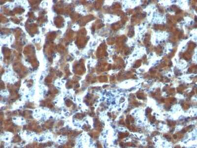 Immunohistochemistry-Paraffin: Retinol Binding Protein RBP Antibody (G4E4) [NBP2-34231]