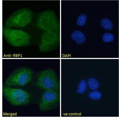 Immunocytochemistry/ Immunofluorescence: Retinol Binding Protein RBP Antibody [NB100-1494]