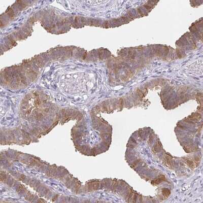 Immunohistochemistry-Paraffin: Retinol Binding Protein RBP Antibody [NBP2-33862]