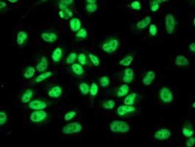 Immunocytochemistry/ Immunofluorescence: Retinol Binding Protein RBP Antibody (OTI2H3) - Azide and BSA Free [NBP2-73852]