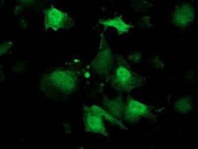 Immunocytochemistry/ Immunofluorescence: Retinol Binding Protein RBP Antibody (OTI2H3) - Azide and BSA Free [NBP2-73852]