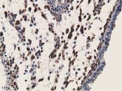 Immunohistochemistry: Retinol Binding Protein RBP Antibody (OTI2H3) - Azide and BSA Free [NBP2-73852]
