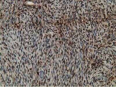 Immunohistochemistry: Retinol Binding Protein RBP Antibody (OTI2H3) - Azide and BSA Free [NBP2-73852]