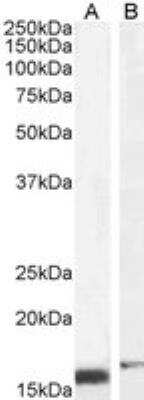 Western Blot: Retinol Binding Protein RBP Antibody [NB100-1494]
