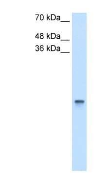 Western Blot: Retinol Binding Protein RBP Antibody [NBP1-57677]