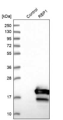 Western Blot: Retinol Binding Protein RBP Antibody [NBP2-33862]