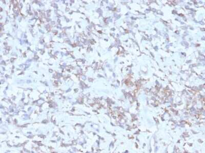 Immunohistochemistry-Paraffin: Retinol Binding Protein RBP Antibody (rRBP1/872) [NBP3-07197]