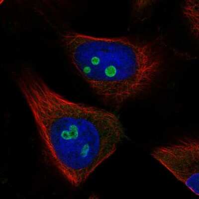 Immunocytochemistry/ Immunofluorescence: Retinol Saturase Antibody [NBP2-58103]