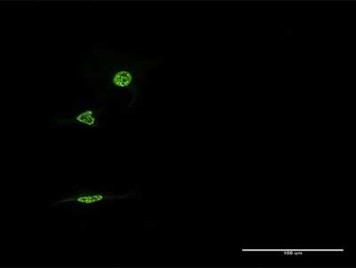 Immunocytochemistry/ Immunofluorescence: Rev-erb A alpha/NR1D1 Antibody (1F4) [H00009572-M16]