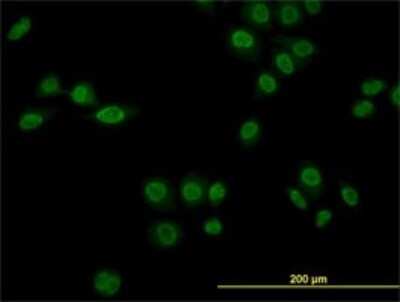 Immunocytochemistry/ Immunofluorescence: Rev-erb A alpha/NR1D1 Antibody (4F6) [H00009572-M02]