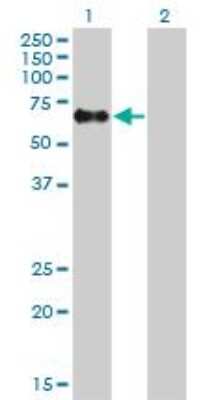 Western Blot: Rev-erb A alpha/NR1D1 Antibody (4F6) [H00009572-M02]