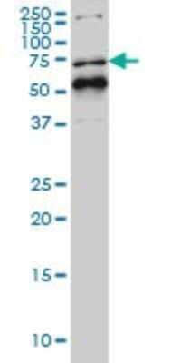 Western Blot: Rev-erb A alpha/NR1D1 Antibody (4F6) [H00009572-M02]
