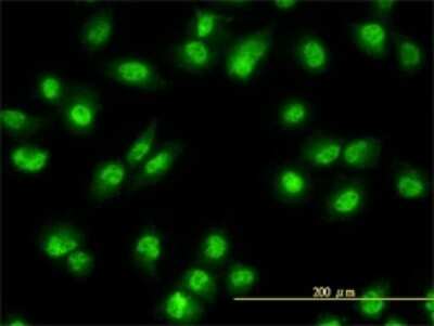 Immunocytochemistry/ Immunofluorescence: Rev-erb beta/NR1D2 Antibody (1G2) [H00009975-M01]