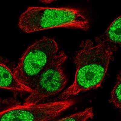 Immunocytochemistry/ Immunofluorescence: Rev-erb beta/NR1D2 Antibody [NBP2-56141]