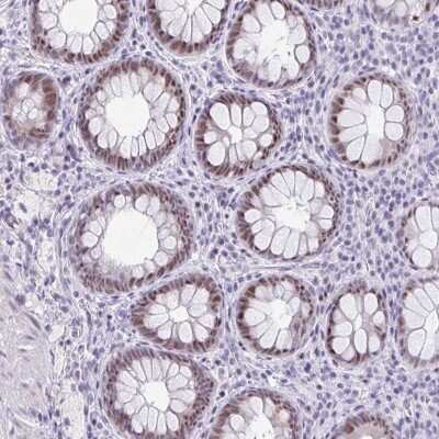 Immunohistochemistry: Rev-erb beta/NR1D2 Antibody [NBP2-47306]