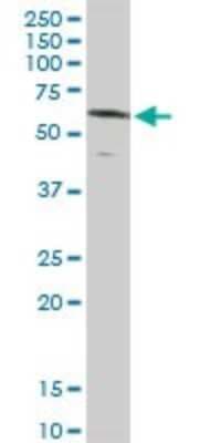 Western Blot: Rev-erb beta/NR1D2 Antibody [H00009975-D01P]