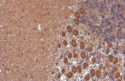 Immunohistochemistry-Paraffin: Rheb Antibody (GT39810) [NBP3-13608]