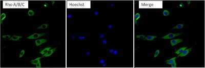 Immunocytochemistry/ Immunofluorescence: RhoA Antibody (1A11-4G10) [NBP2-22528]