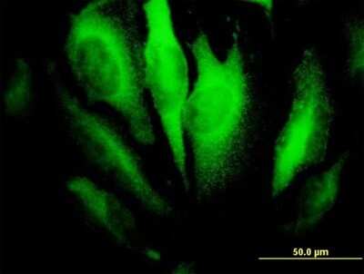 Immunocytochemistry/ Immunofluorescence: RhoA Antibody (1B12) [H00000387-M04]