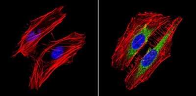 Immunocytochemistry/ Immunofluorescence: RhoA Antibody (1B3-4A10) [NBP2-22529]