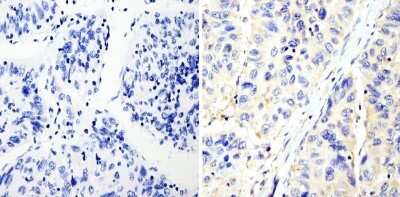 Immunohistochemistry-Paraffin: RhoA Antibody (1B3-4A10) [NBP2-22529]