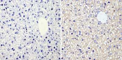 Immunohistochemistry-Paraffin: RhoA Antibody (1B3-4A10) [NBP2-22529]