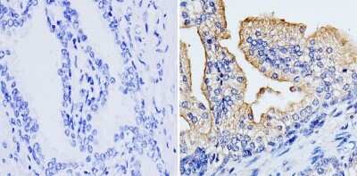 Immunohistochemistry-Paraffin: RhoA Antibody (1B3-4A10) [NBP2-22529]
