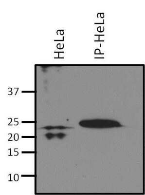 Immunoprecipitation: RhoA Antibody (1B3-4A10) [NBP2-22529]