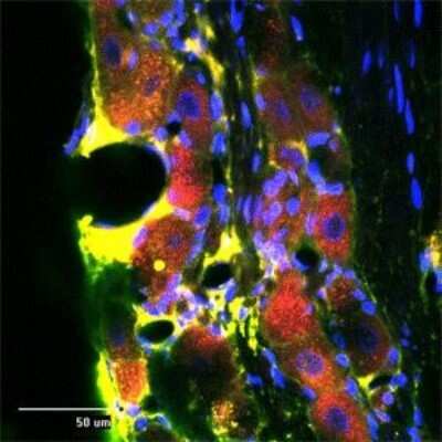 Immunocytochemistry/ Immunofluorescence: RhoA Antibody [NB100-91273]