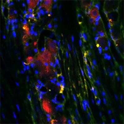 Immunocytochemistry/ Immunofluorescence: RhoA Antibody [NB100-91273]