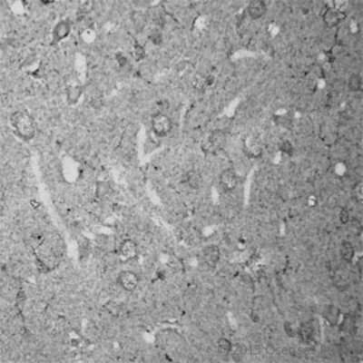 Immunohistochemistry: RhoA Antibody [NB100-91273]
