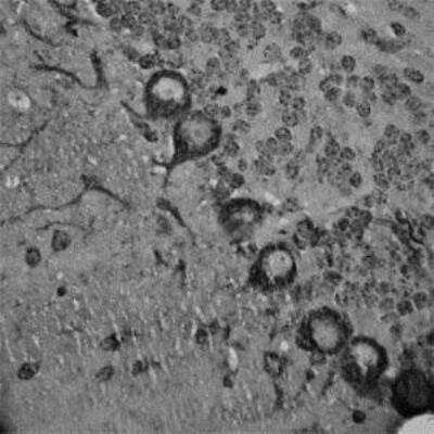 Immunohistochemistry-Paraffin: RhoA Antibody [NB100-91273]