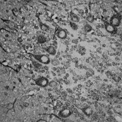 Immunohistochemistry-Paraffin: RhoA Antibody [NB100-91273]