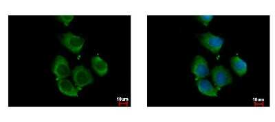 Immunocytochemistry/ Immunofluorescence: RhoC Antibody [NBP2-20156]