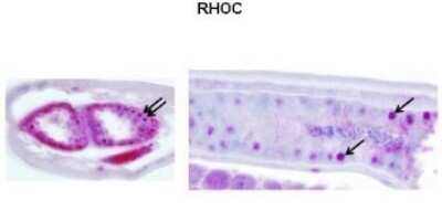 Immunohistochemistry: RhoC Antibody [NBP1-58351]
