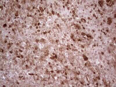Immunohistochemistry: RhoC Antibody (OTI3A5) - Azide and BSA Free [NBP2-73888]