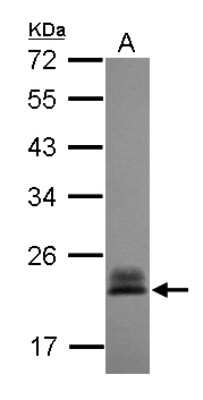 Western Blot: RhoC Antibody [NBP2-20156]