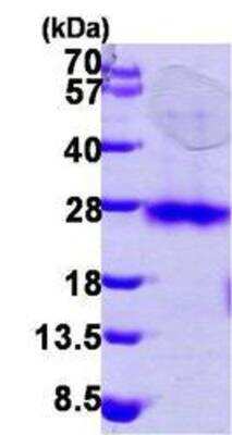 Western Blot: Recombinant Human RhoC His Protein [NBP1-45291]