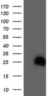 Western Blot: RhoD Antibody (OTI2F7) [NBP2-01462]