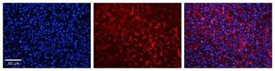 Immunohistochemistry: RhoD Antibody [NBP1-58359]