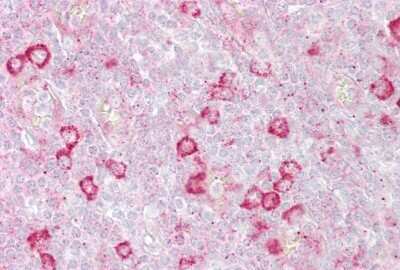 Immunohistochemistry-Paraffin: RhoD Antibody [NBP1-58359]