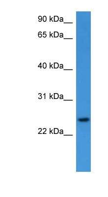 Western Blot: RhoG Antibody [NBP1-79794]