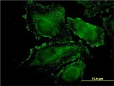 Immunocytochemistry/ Immunofluorescence: RhoJ Antibody (1E4) [H00057381-M01]