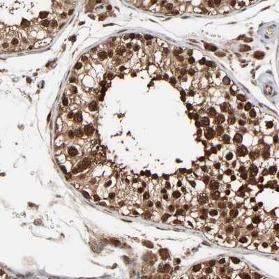 Immunohistochemistry-Paraffin: RhoJ Antibody [NBP1-89012]