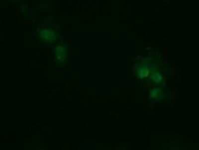 Immunocytochemistry/ Immunofluorescence: RhoJ Antibody (OTI1D7) - Azide and BSA Free [NBP2-73892]