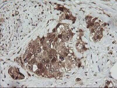 Immunohistochemistry: RhoJ Antibody (OTI1D7) - Azide and BSA Free [NBP2-73892]